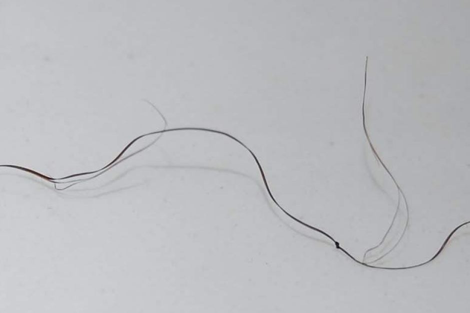 Scientists Find A 7 Billion Year Old Pubic Hair Believed To Belong